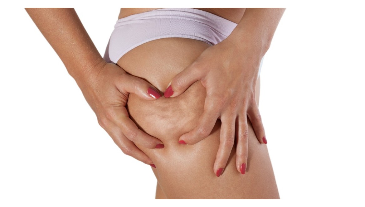 S.O.S Cellulite, Corri ai Ripari!